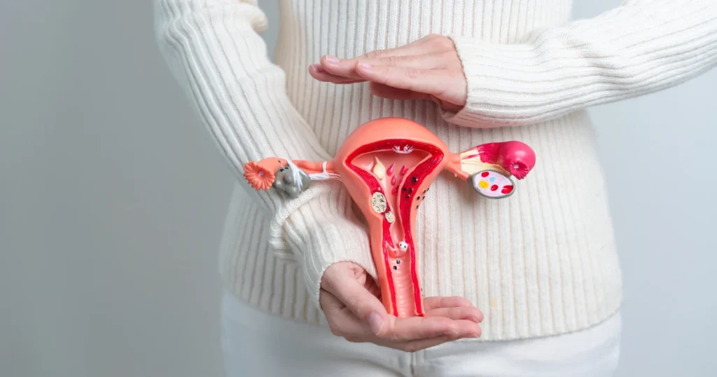 Cáncer Cervicouterino en Estelí