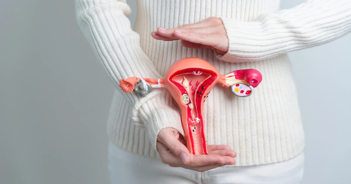 Cáncer Cervicouterino en Estelí